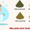 trẻ sơ sinh phân thế nào là bình thường